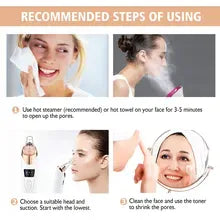 Blackhead Remover